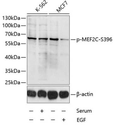 Western Blot: MEF2C [p Ser396] AntibodyBSA Free [NBP3-05386]